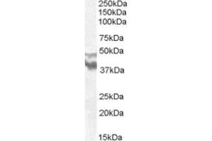 Image no. 1 for anti-Dyslexia Susceptibility 1 Candidate 1 (DYX1C1) (N-Term) antibody (ABIN374955) (DYX1C1 抗体  (N-Term))