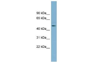 WB Suggested Anti-TMLHE Antibody Titration: 0. (TMLHE 抗体  (Middle Region))