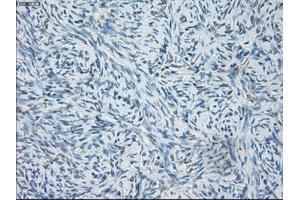 Immunohistochemical staining of paraffin-embedded colon tissue using anti-SORDmouse monoclonal antibody. (SORD 抗体)