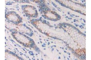 IHC-P analysis of Human Stomach Tissue, with DAB staining. (IL1R1 抗体  (AA 120-208))