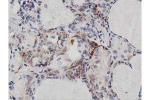 Immunohistochemical staining of paraffin-embedded Human liver tissue using anti-PECR mouse monoclonal antibody. (PECR 抗体)