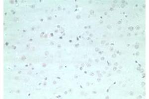 Image no. 1 for anti-rho GTPase Activating Protein 20 (ARHGAP20) (AA 570-620) antibody (ABIN207767) (ARHGAP20 抗体  (AA 570-620))