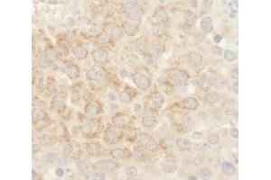 Immunohistochemistry (IHC) image for anti-BCL2-Associated Agonist of Cell Death (BAD) (AA 1-50) antibody (ABIN7448932)