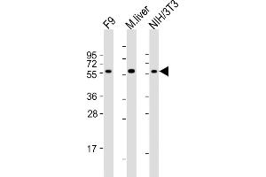 All lanes : Anti-Foxh1 Antibody (C-term) at 1:2000 dilution Lane 1: F9 whole cell lysates Lane 2: mouse liver lysates Lane 3: NIH/3T3 whole cell lysates Lysates/proteins at 20 μg per lane. (FOXH1 抗体  (C-Term))
