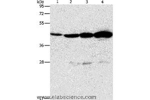 Western blot analysis of Mouse thymus tissue and A549 cell, Lovo and K562 cell, using APOBEC3D Polyclonal Antibody at dilution of 1:580 (APOBEC3D 抗体)