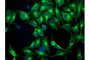 Immunofluorescent staining of HeLa cells using anti-TUBB4 mouse monoclonal antibody (ABIN2454621). (TUBB4 抗体)
