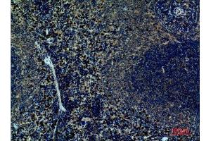 Immunohistochemistry (IHC) image for anti-Integrin alpha 4 (ITGA4) (Internal Region) antibody (ABIN6287306)