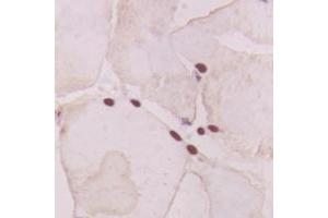 anti-Guanine Nucleotide Binding Protein (G Protein), alpha Transducing Activity Polypeptide 1 (GNAT1) (Center) antibody