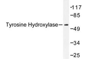 Image no. 1 for anti-Tyrosine Hydroxylase (TH) antibody (ABIN272085) (Tyrosine Hydroxylase 抗体)