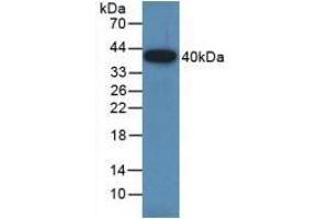 Detection of Recombinant GAP43, Rat using Polyclonal Antibody to Growth Associated Protein 43 (GAP43) (GAP43 抗体  (AA 8-226))