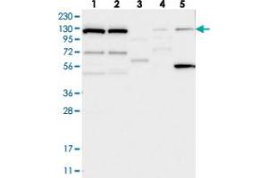 Western blot analysis of Lane 1: RT-4, Lane 2: U-251 MG, Lane 3: Human Plasma, Lane 4: Liver, Lane 5: Tonsil with DNAJC6 polyclonal antibody  at 1:250-1:500 dilution. (DNAJC6 抗体)