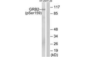 Western blot analysis of extracts from HT29 cells treated with serum 20% 15', using GRB2 (Phospho-Ser159) Antibody. (GRB2 抗体  (pSer159))