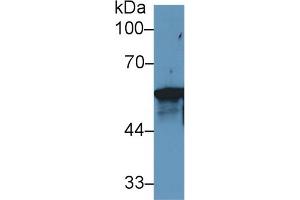 Western blot analysis of Human MCF7 cell lysate, using Rat KRT6A Antibody (1 µg/ml) and HRP-conjugated Goat Anti-Rabbit antibody ( (KRT6A 抗体  (AA 323-461))