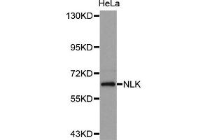 Western Blotting (WB) image for anti-Nemo-Like Kinase (NLK) antibody (ABIN1873910) (Nemo-Like Kinase 抗体)