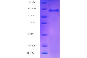 SDS-PAGE (SDS) image for F-Box and Leucine-Rich Repeat Protein 2 (FBXL2) (AA 1-423), (full length) protein (His-SUMO Tag) (ABIN5711963)