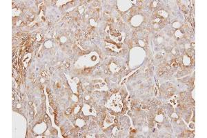 IHC-P Image Immunohistochemical analysis of paraffin-embedded NCI-N87 xenograft, using ITI-H3, antibody at 1:100 dilution. (ITIH3 抗体)