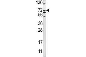 Image no. 1 for anti-SMAD Specific E3 Ubiquitin Protein Ligase 2 (SMURF2) (C-Term) antibody (ABIN357472) (SMURF2 抗体  (C-Term))