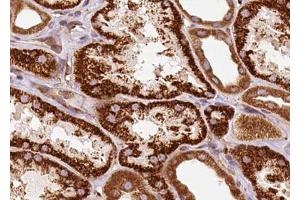 ABIN6272939 at 1/100 staining Human kidney tissue by IHC-P. (Centrin 1 抗体  (Internal Region))
