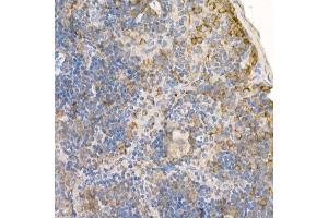 Immunohistochemistry of paraffin-embedded mouse spleen using [KO Validated] RA Rabbit pAb (ABIN3021646, ABIN3021647, ABIN3021648 and ABIN1513457) at dilution of 1:100 (40x lens). (RAB5 抗体  (AA 1-215))