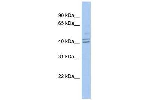 PROCA1 antibody used at 1 ug/ml to detect target protein. (PROCA1 抗体  (Middle Region))