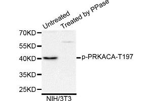 Western blot analysis of extracts of NIH/3T3 cells, using Phospho-PRKACA-T197 antibody. (PRKACA 抗体)