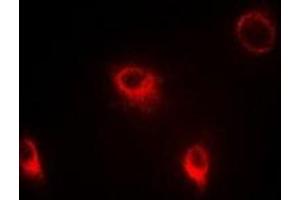 Immunofluorescent analysis of SFRP4 staining in Hela cells. (SFRP4 抗体)
