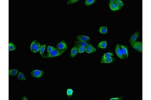 Immunofluorescent analysis of HepG2 cells using ABIN7161568 at dilution of 1:100 and Alexa Fluor 488-congugated AffiniPure Goat Anti-Rabbit IgG(H+L) (NNMT 抗体  (AA 86-157))