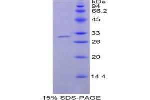 SDS-PAGE analysis of Human NNMT Protein. (NNMT 蛋白)