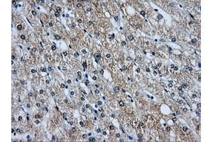 Immunohistochemical staining of paraffin-embedded liver tissue using anti-BIRC7mouse monoclonal antibody. (BIRC7 抗体)