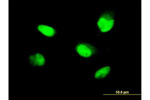 Immunofluorescence of monoclonal antibody to ZNF207 on HeLa cell. (ZNF207 抗体  (AA 1-110))