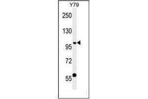 Western blot analysis of PHF20 Antibody (N-term) in Y79 cell line lysates (35ug/lane). (PHF20 抗体  (N-Term))