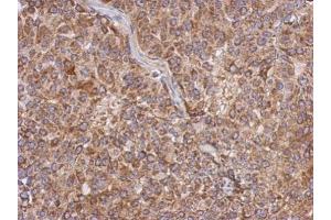 IHC-P Image Immunohistochemical analysis of paraffin-embedded Huh7 xenograft, using APOL1, antibody at 1:500 dilution. (APOL1 抗体)