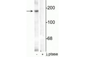 Western blot of rat hippocampal lysate showing specific immunolabeling of the ~180 kDa NR2B subunit phosphorylated at Tyr1336 in the first lane (-). (GRIN2B 抗体  (pTyr1336))