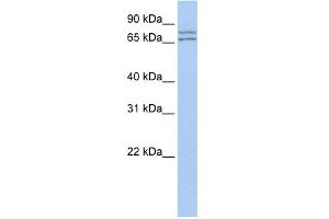 WB Suggested Anti-DDX27 Antibody Titration:  0. (DDX27 抗体  (N-Term))