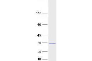 Validation with Western Blot