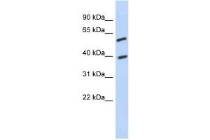 WB Suggested Anti-C6orf146 Antibody Titration: 0. (FAM217A 抗体  (Middle Region))