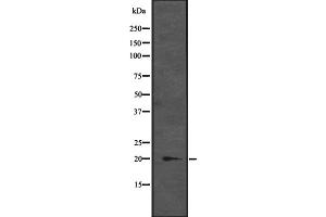 Western blot analysis of CENPM expression in K-562 cell lysate at 25ug/lane,The lane on the left is treated with the antigen-specific peptide. (CENPM 抗体  (Internal Region))