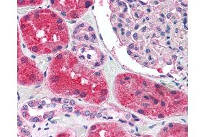 Immunohistochemistry (IHC) image for anti-Potassium Intermediate/small Conductance Calcium-Activated Channel, Subfamily N, Member 2 (KCNN2) (C-Term) antibody (ABIN1048991)