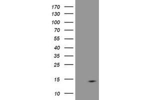 Image no. 4 for anti-D-Dopachrome Tautomerase (DDT) antibody (ABIN1497798) (DDT 抗体)