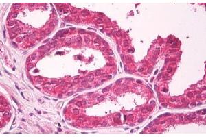 Anti-CXADR antibody IHC staining of human prostate. (Coxsackie Adenovirus Receptor 抗体)