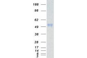 Western Blotting (WB) image for Casein Kinase 1, epsilon (CSNK1E) (Transcript Variant 2) protein (Myc-DYKDDDDK Tag) (ABIN2713194)