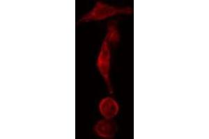 ABIN6275567 staining  Hela cells by IF/ICC. (SH3GLB2 抗体  (C-Term))