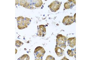 Immunohistochemistry of paraffin-embedded human stomach using TUBB8 antibody. (Tubulin, beta 8 抗体)