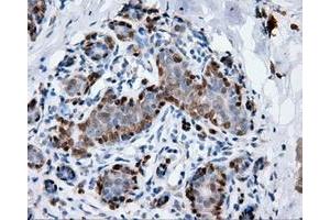 Immunohistochemical staining of paraffin-embedded breast tissue using anti-ANXA1 mouse monoclonal antibody. (Annexin a1 抗体)