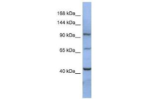 WB Suggested Anti-RBM12  Antibody Titration: 0. (RBM12 抗体  (N-Term))