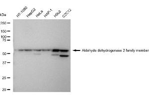 Western blotting analysis using Aldehyde dehydrogenase 2 family member antibody (ABIN7797554).