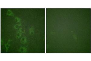 Immunofluorescence staining of methanol-fixed HuvEc cells using Histamine H1 Receptor (Phospho-Ser398) Antibody. (HRH1 抗体  (pSer398))
