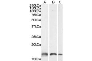ABIN184738 (1µg/ml) staining of Human Lymph node (A), Mouse Brain (B) and Rat Brain (C) lysate (35µg protein in RIPA buffer).