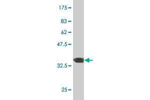 Western Blot detection against Immunogen (36. (ERN1 抗体  (AA 401-500))