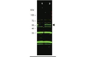 Western blot using anti-ING3 antibody shows detection of a band at. (ING3 抗体  (Isoform 1))